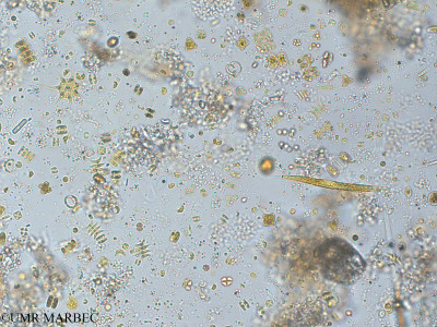 phyto/Pertuis Charentais/Tasdon_st2/PAMPAS 2019-2021/Teilingia sp (TASDON_St2_R1_0719014).tif(copy)_thumb.jpg